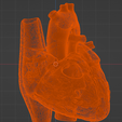 1.png 3D Model of Heart with Tetralogy of Fallot (ToF)