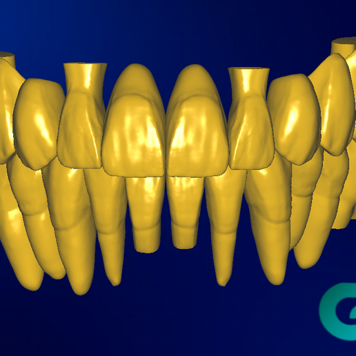 STL file GRIN DESIGN 2023 Exocad Tooth library 🦷 ・3D printing template ...