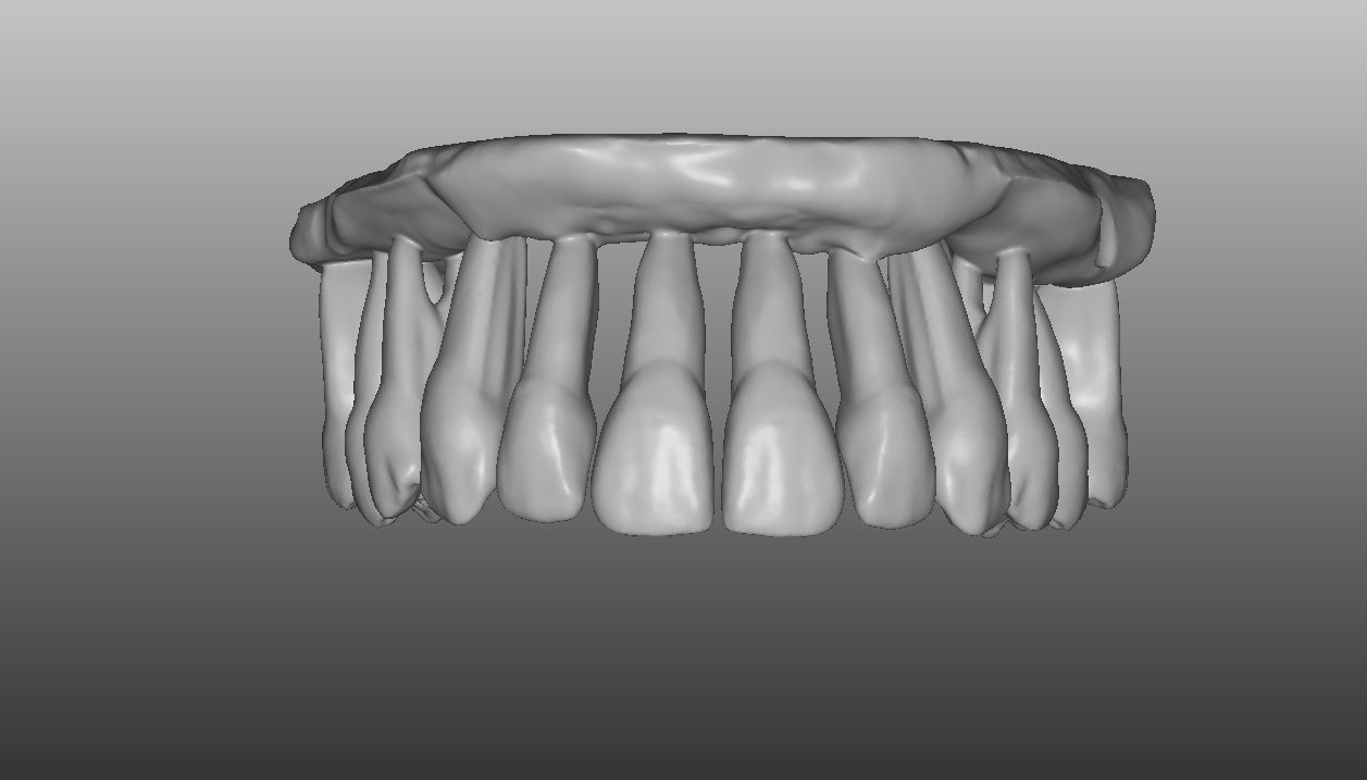 imagen modelo sup 2.jpg Fichier STL Morphologie dentaire "mâchoire supérieure".・Modèle pour imprimante 3D à télécharger, darojbl