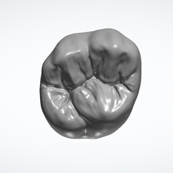 Unit-3.png STL file Maxillary First Molar Anatomy・3D printable design to download