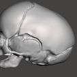 FOTO-DE-LATERAL.jpg FETAL SKULL