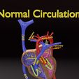 ps-0009.jpg PDA Patent Ductus Arteriosus vs Normal blood circulation