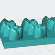 Capture-d'écran-2025-05-10-122607.png dental restorative model of upper posterior teeth