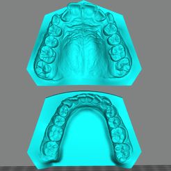 ANA-SANTIESTEBAN1212.jpg STL file Dental Model/ Dental Model・3D printer design to download