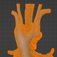 29.png 3D Model of Double Aortic Arch
