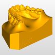 Mandible-Details.jpg Maxilla and Mandible orthodontic study models with an ABO 2013 base.
