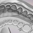 37.jpg 3D Dental Jaws Replica with Detachable Teeth