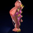 37.jpg Fibroid Uterus Human female 3D