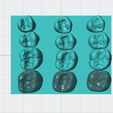 Capture-d'écran-2025-05-10-122548.png dental restorative model of upper posterior teeth