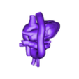 papvc.stl 3D Model of Partial Anomalous Pulmonary Venous Connection