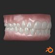 04_BLENDER.jpg Human teeth with gums