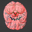6.png 3D Model of Brain and Aneurysm