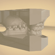 Screenshot_18.png Digital Orthodontic Study Models with Virtual Bases