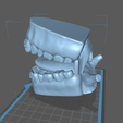 M6.png Mouth with Braces
