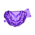 789513050_20250210_1316_Tech_01__-_oprava_A3,5_H_flex_Antag.stl DIGITAL FLEXIBLE UPPER PARTIAL DENTURE (3D models !!!) - 7 stl files for download)