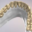 20.jpg 3D Dental Jaws Replica with Detachable Teeth