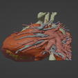 2.png 3D Model of Human Heart with Mirror Dextrocentric - generated from real patient