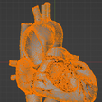 25.png Modèle 3D de la valve aortique bicuspide (BAV)