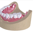 15.png Digital Full Dentures with Combined Glue-in Teeth Arch