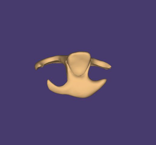 Clipboard-2024-06-11-19-30-22.jpg DIGITAL FLIPPER (Tooth 12) - 3stl. files :  base + artificial tooth + monoblock