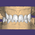 VESTIBULAR.png ENCERADO / MOCK-UP #2