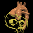 15.png 3D Model of Transposition of the Great Arteries Open Duct