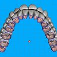 04.jpg Teeth for temporary crowns - maxillary+mandibular-teeth