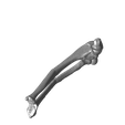 Both_bone_malunion_sag_20_degrees.png Both bone malunion sag 20 degrees.stl