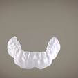 Screenshot_20.png STL file Full Dentures with Many Production Options・3D printable model to download, LabMagic3D