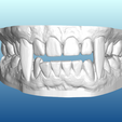 VTfront.png Vampire Teeth Dental Model for Halloween (2 piece - No Supports)