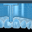 Screenshot_2.png Digital Dental Unsectioned Study Model
