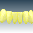 Screenshot_6.png Digital Full Dentures for Gluedin Teeth with Manual Reduction
