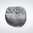 dent 46.JPG Morphology tooth 46