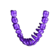 skull - STL12-_Mandibular_teeth.stl 3D Model of Skull with Brain and Brain Stem - best version