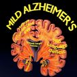 ps32.jpg Alzheimer Disease Brain coronal slice