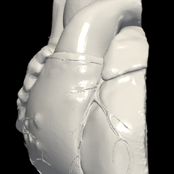 1.png Modèle 3D du cœur (plan apical des deux cavités)