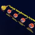retinal-detachment-types-eye-3d-model-blend-83.jpg Retinal detachment types eye 3D model