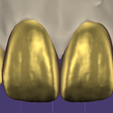 preview-5.png All Collection For exocad
