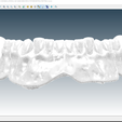Screenshot_13.png Digital Try-in Full Dentures for Injection Molding