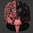 10.png 3D Model of Brain - section