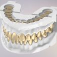 2.jpg 3D Dental Jaws Replica with Detachable Teeth