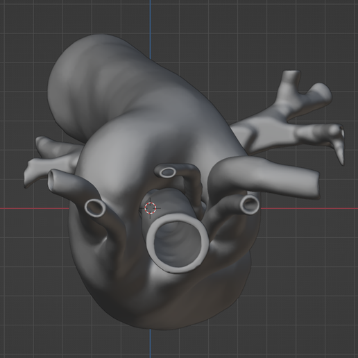 20.png 3D Model of Double Aortic Arch