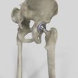 Image4.jpg Hip Replacement model