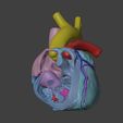 01.jpg 法洛氏四联症心脏 3D 模型