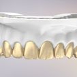 25.jpg 3D Dental Jaws Replica with Detachable Teeth