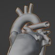 27.png 3D Model of Heart after Fontan Procedure