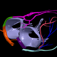 18.png 3D Model of Bicuspid Aortic Valve (BAV)