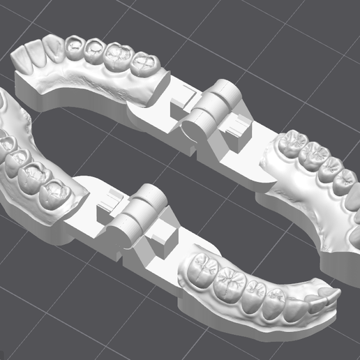 👽 Occlusal Restoration Training Models – Upper & Lower・ 3D File