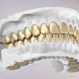 1.jpg 3D Dental Jaws Replica with Detachable Teeth