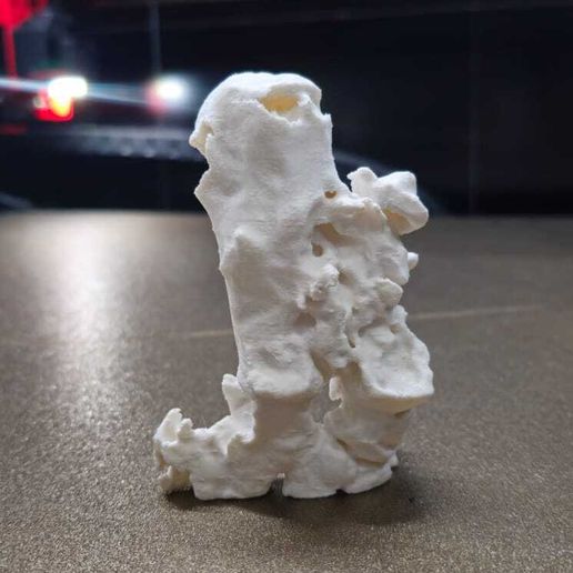 WhatsApp-Image-2025-06-04-at-4.22.10-PM-1.jpeg Tibia and Fibula